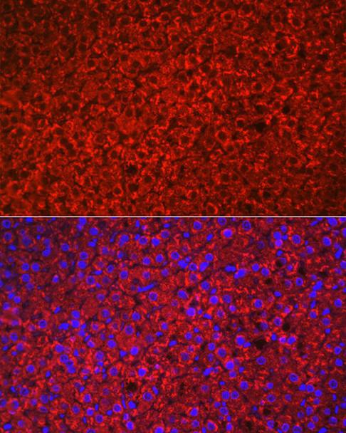 HSD3B1 Rabbit Polyclonal Antibody (CAB8035)