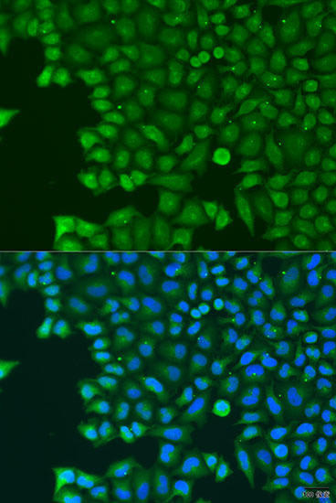 ABCE1 Rabbit Polyclonal Antibody (CAB8146)