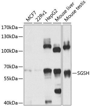 SGSH Rabbit Polyclonal Antibody (CAB8148)