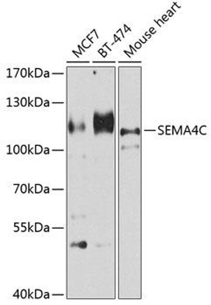 SEMA4C Rabbit Polyclonal Antibody (CAB8225)