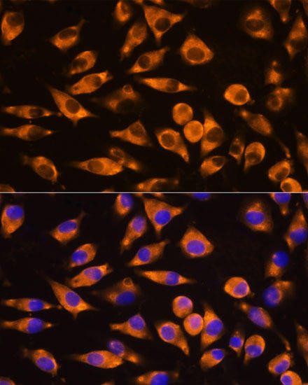 CEP55 Rabbit Polyclonal Antibody (CAB8229)