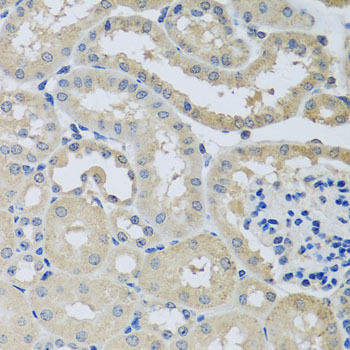 CHMP1B Rabbit Polyclonal Antibody (CAB8239)