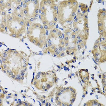MRPS22 Rabbit Polyclonal Antibody (CAB8319)