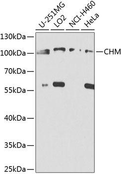 CHM Rabbit Polyclonal Antibody (CAB8345)