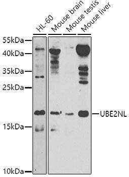 UBE2NL Rabbit Polyclonal Antibody (CAB8381)
