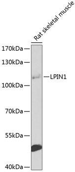 Lipin 1 Rabbit Polyclonal Antibody (CAB8486)