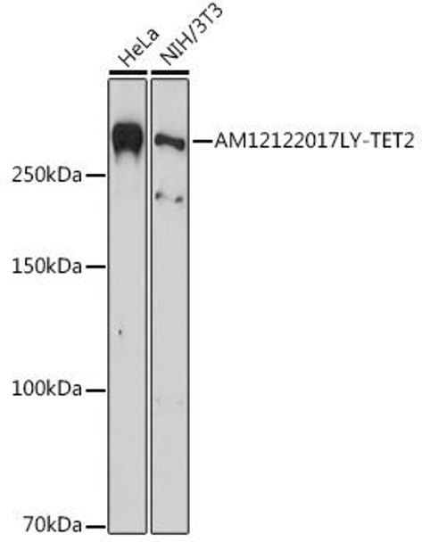 Anti-TET2 Mouse Monoclonal Antibody (CAB20008)