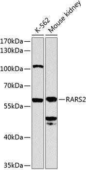 RARS2 Rabbit Polyclonal Antibody (CAB8503)