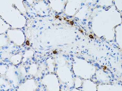 TEFM Rabbit Polyclonal Antibody (CAB8511)