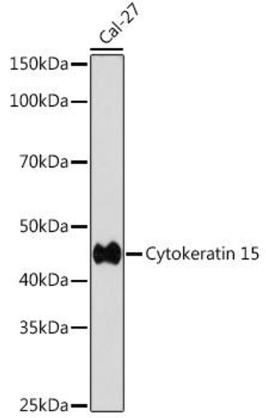 Anti-Cytokeratin 15 Antibody (CAB4854)