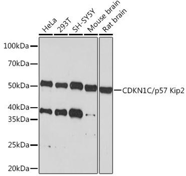 Anti-CDKN1C/p57 Kip2 Antibody (CAB6843)