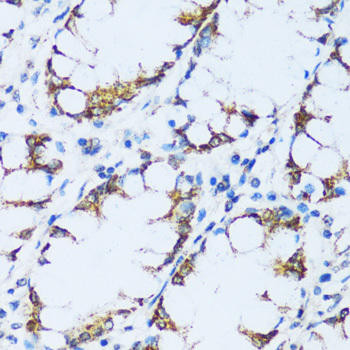 C1QC Rabbit Polyclonal Antibody (CAB9227)