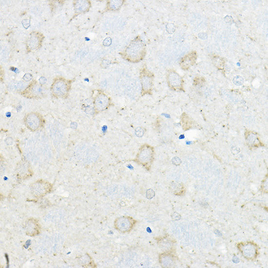 GIPR Rabbit Polyclonal Antibody (CAB9816)