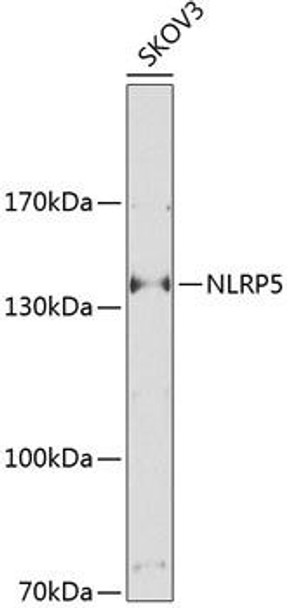 NLRP5 Rabbit Polyclonal Antibody (CAB9886)