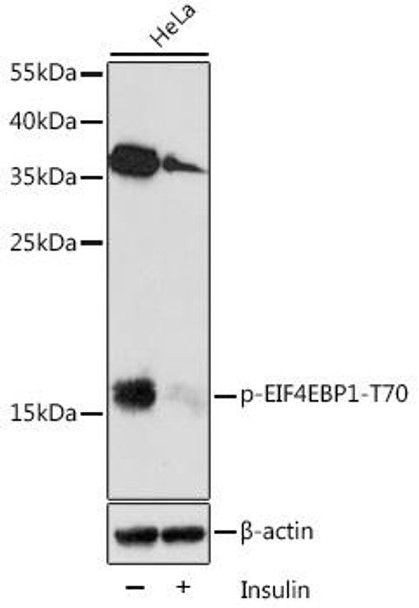 Phospho-eIF4EBP1-T70 Rabbit Polyclonal Antibody (CABP0031)