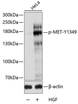 Phospho-MET-Y1349 Rabbit Polyclonal Antibody (CABP0077)