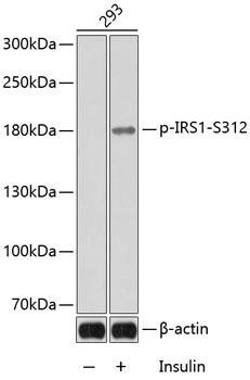 Phospho-IRS1-S312 Rabbit Polyclonal Antibody (CABP0181)