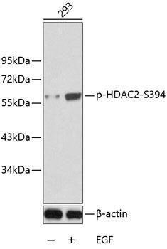 Phospho-HDAC2-S394 Polyclonal Antibody (CABP0201)