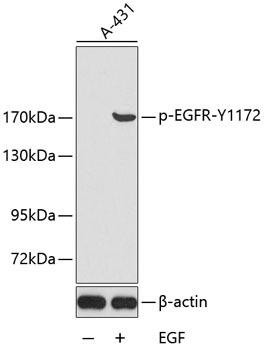 Phospho-EGFR-Y1172 Rabbit Polyclonal Antibody (CABP0218)