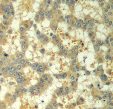 Phospho-Syk-Y323 Rabbit Polyclonal Antibody (CABP0291)