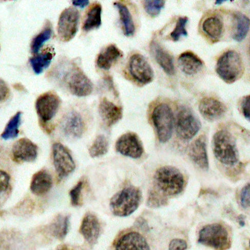 Phospho-HDAC8-S39 Rabbit Polyclonal Antibody (CABP0360)