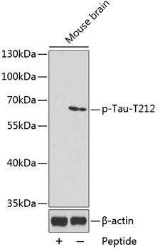 Phospho-Tau-T212 Polyclonal Antibody (CABP0400)