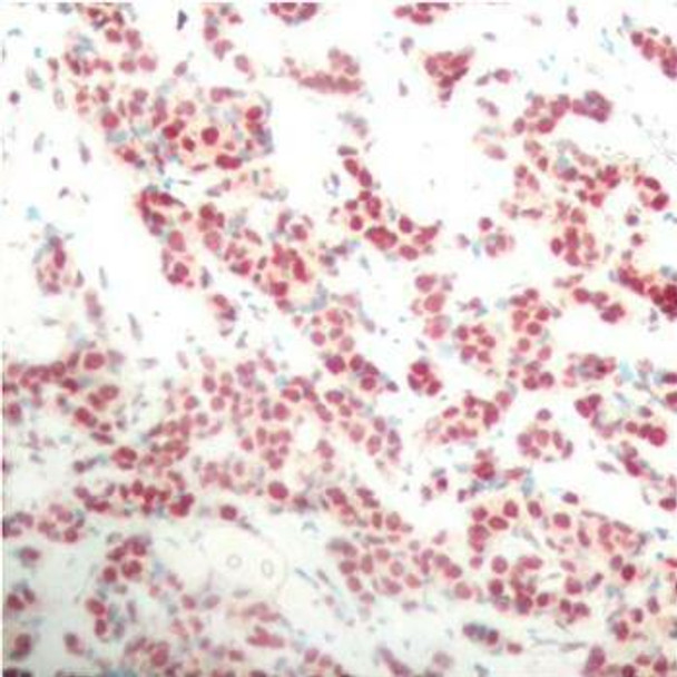 Phospho-NF-κB2-S866 Rabbit Polyclonal Antibody (CABP0418)