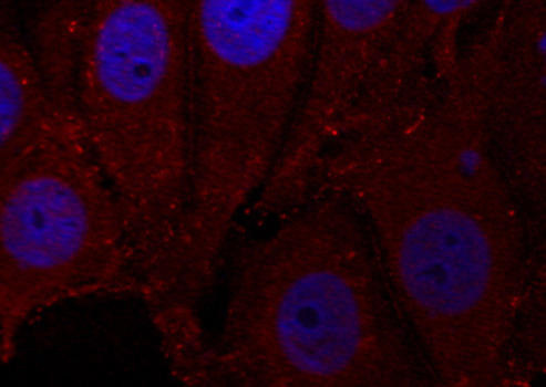 Phospho-α-Synuclein-Y133 Polyclonal Antibody (CABP0451)
