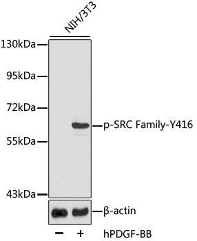 Phospho-SRC Family-Y416 Rabbit Polyclonal Antibody (CABP0511)