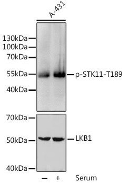 Phospho-STK11-T189 Rabbit Polyclonal Antibody (CABP0603)