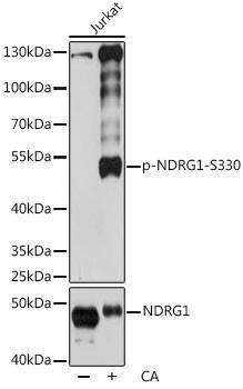 Phospho-NDRG1-S330 Rabbit Polyclonal Antibody (CABP0807)