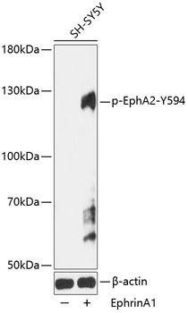 Phospho-EphA2-Y594 Rabbit Polyclonal Antibody (CABP0818)