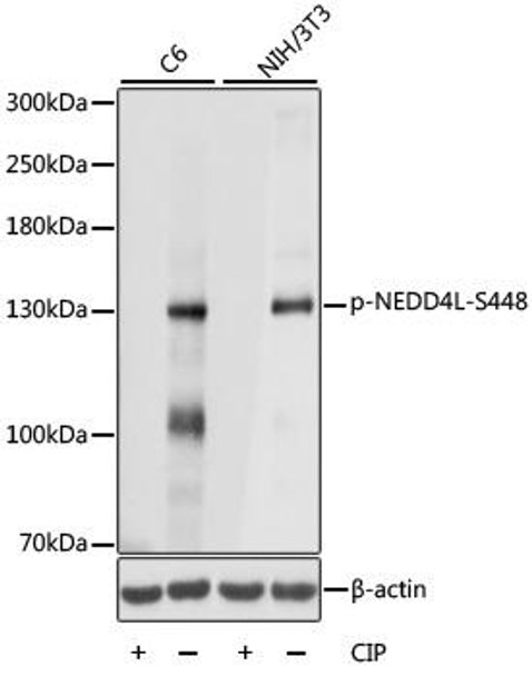 Phospho-NEDD4L-S448 Rabbit Polyclonal Antibody (CABP0843)