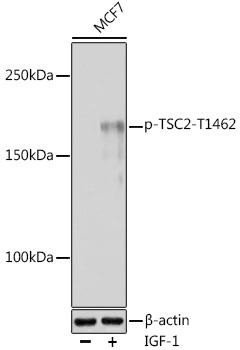 Phospho-TSC2-T1462 Rabbit Polyclonal Antibody (CABP0866)