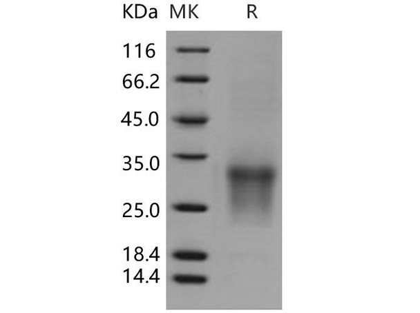 Human CD82/KAI Recombinant Protein (His Tag) (RPES0093)