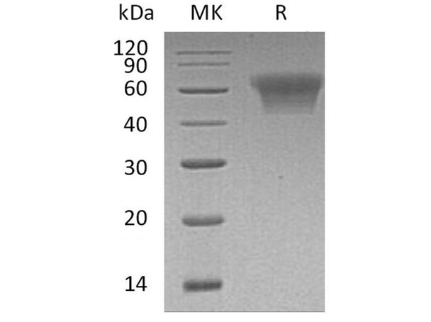 Human CD55/DAF Recombinant Protein (RPES0095)