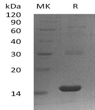 Human PLA2G16 Recombinant Protein (RPES0096)