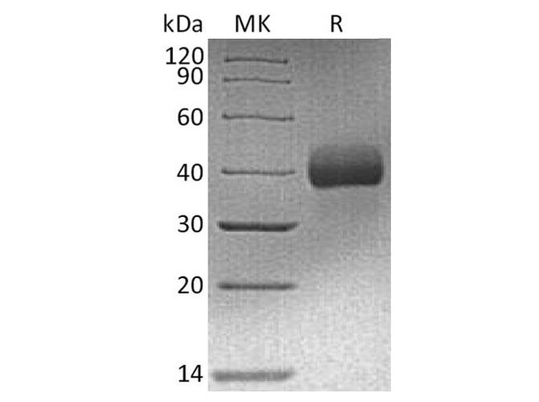 Human EpCAM/TROP Recombinant Protein (RPES0106)