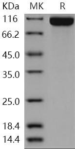 Human DPP10/DPRP3 Recombinant Protein (His Tag) (RPES0109)