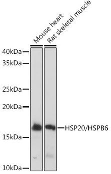 Anti-HSP20/HSPB6 Antibody (CAB9091)