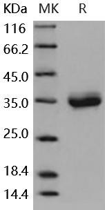 Mouse CXADR/CAR Recombinant Protein (His Tag) (Active) (RPES0157)
