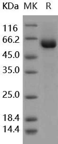 Human tPA/PLAT Recombinant Protein (RPES0158)