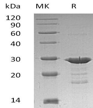 Human GRB2 Recombinant Protein (RPES0160)