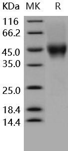 Human CD16a/FCGR3A Recombinant Protein (RPES0171)