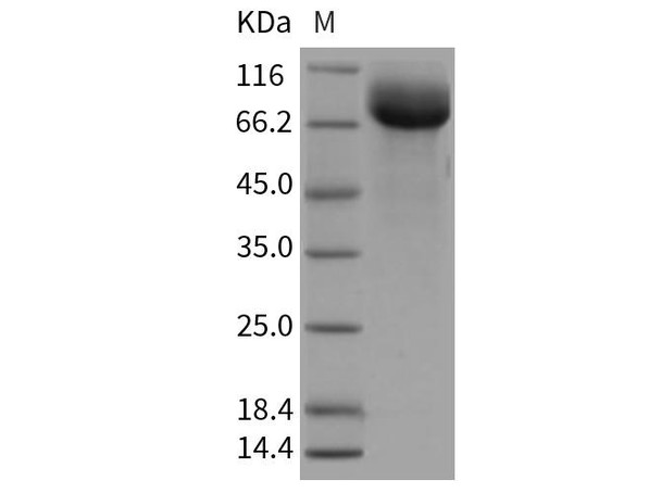 Rat HepaCAM2 Recombinant Protein (Fc Tag) (RPES0176)