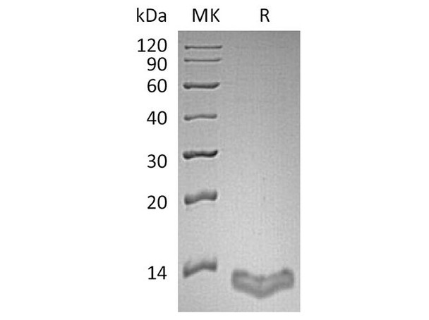Human S100A16/S100F Recombinant Protein (RPES0210)