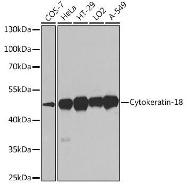 Anti-Cytokeratin-18 Mouse Monoclonal Antibody (CAB0389)