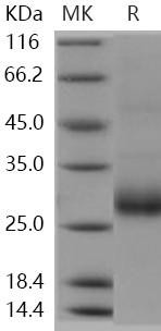 Human RANKL/TNFSF11 Recombinant Protein  (RPES0269)