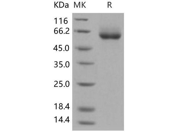 Human ENPP7/NPP-7 Recombinant Protein (RPES0270)