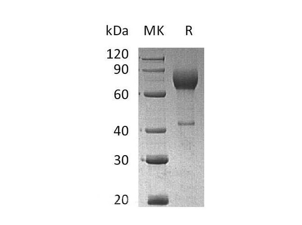 Mouse IL2Ra/CD25 Recombinant Protein (RPES0303)